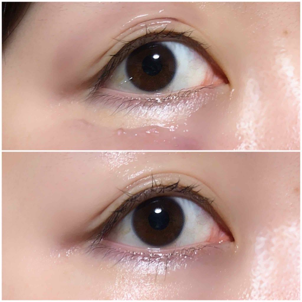 アイジャムB/eyejam/アイケア・アイクリームを使ったクチコミ(4枚目)