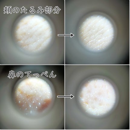 リードルショット300/VT/美容液を使ったクチコミ(4枚目)