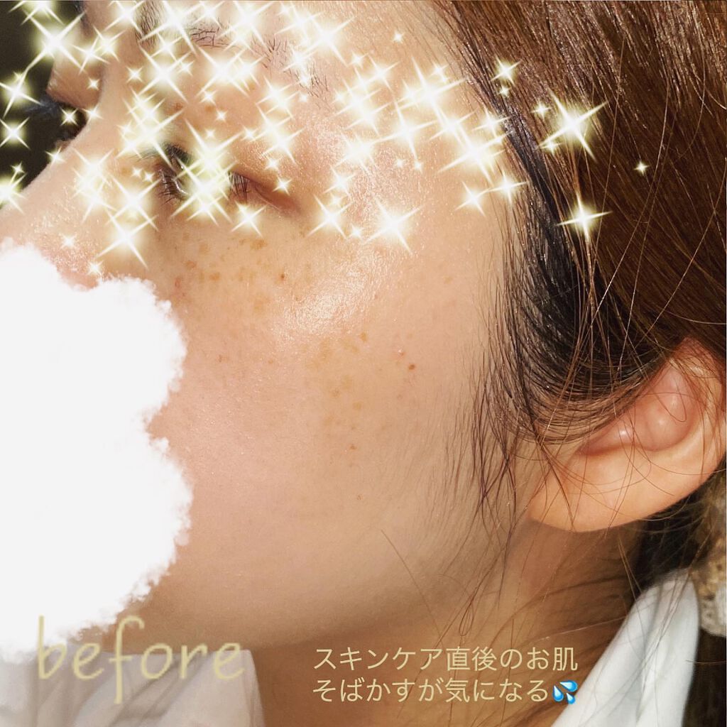 パーフェクトカバー コンシーラーパレット/Dear.A/パレットコンシーラーを使ったクチコミ(3枚目)