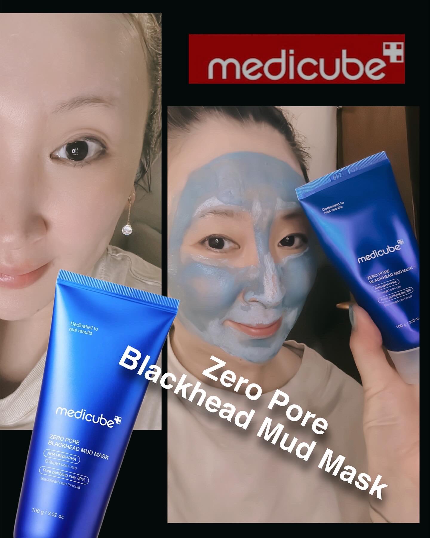 ゼロ毛穴クレイパック/MEDICUBE/洗い流すパック・マスクを使ったクチコミ（1枚目）