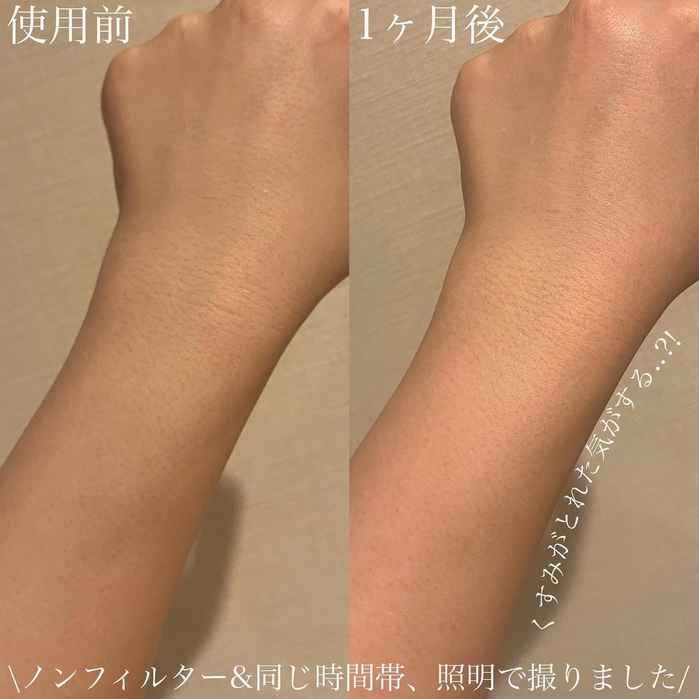 薬用ホワイトコンク ボディシャンプーC II/ホワイトコンク/ボディソープを使ったクチコミ(3枚目)