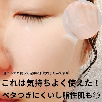 センテラ クイックカーミングパッド/SKIN1004/トナーパッドを使ったクチコミ(4枚目)