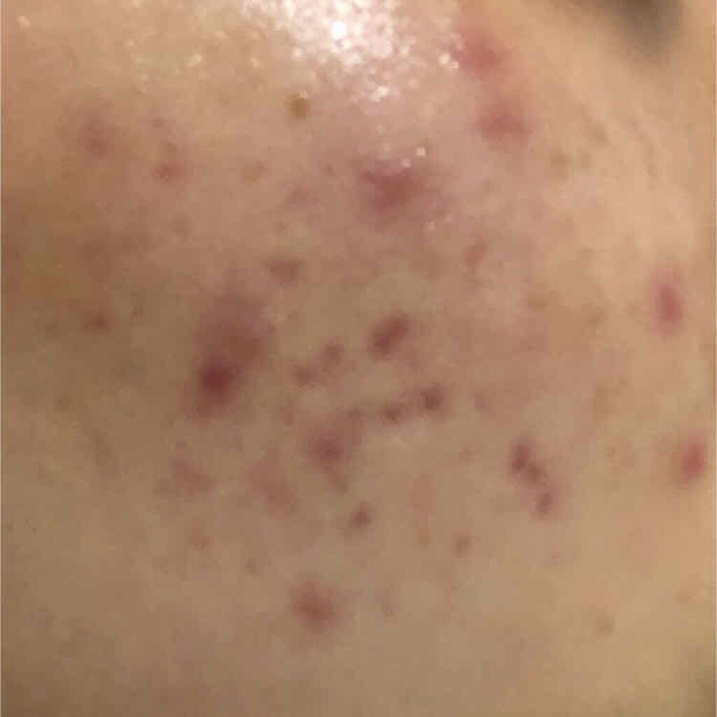 キールズ DS クリアリーブライト エッセンス[医薬部外品]/Kiehl's/美容液を使ったクチコミ（3枚目）