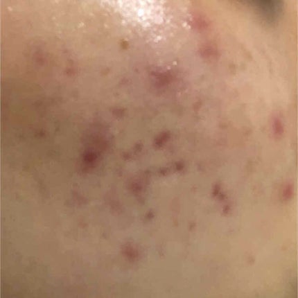 ヴァセリン アドバンスドリペア ボディローション 無香料/ヴァセリン/ボディローションを使ったクチコミ(3枚目)