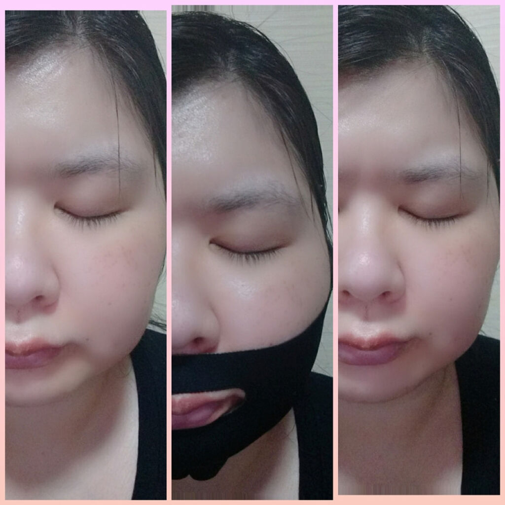 ゼロスポットvパック Today S Cosmeの効果に関する口コミ ポップベリー株式会社様より Today S By えりぃ 混合肌 30代後半 Lips