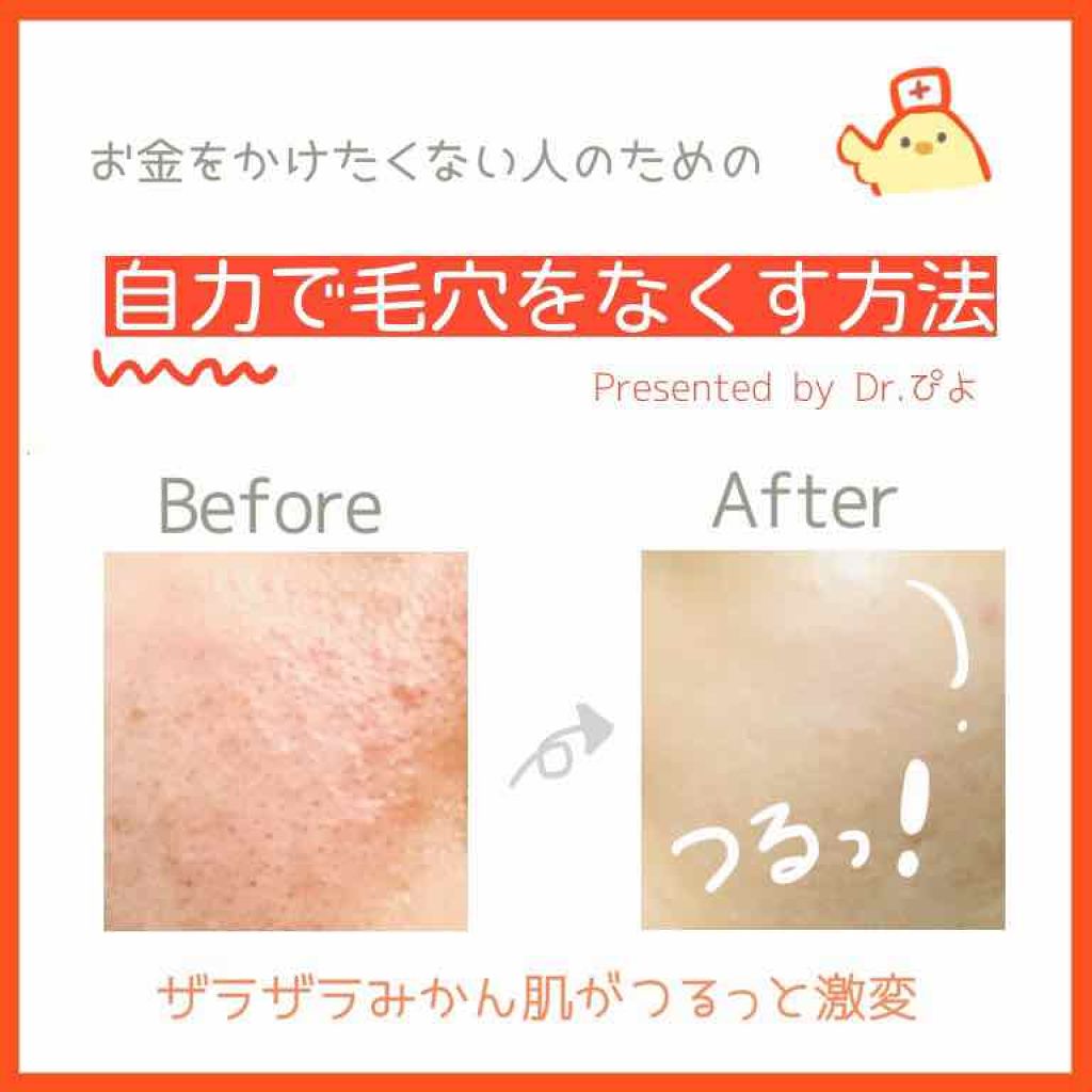 チョコラBBピュア (医薬品)/チョコラBB/その他を使ったクチコミ（1枚目）