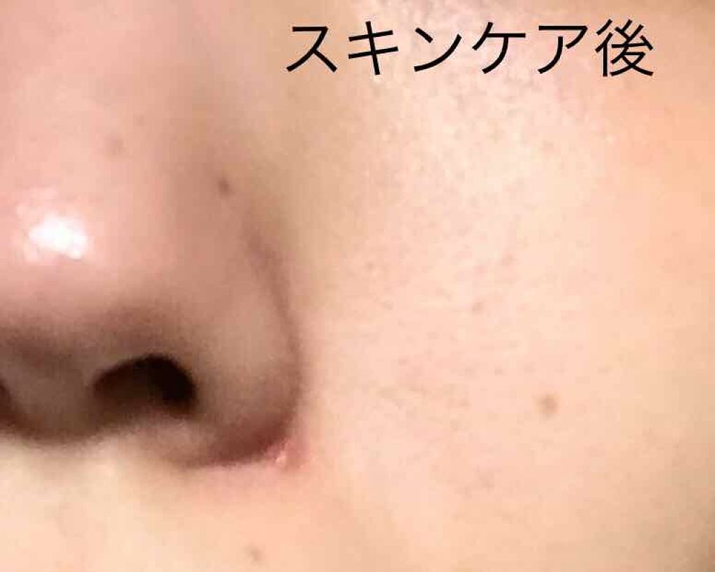 日本酒の化粧水/菊正宗/化粧水を使ったクチコミ(3枚目)