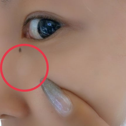 クリアパッチ/Angelab/にきびパッチを使ったクチコミ(3枚目)