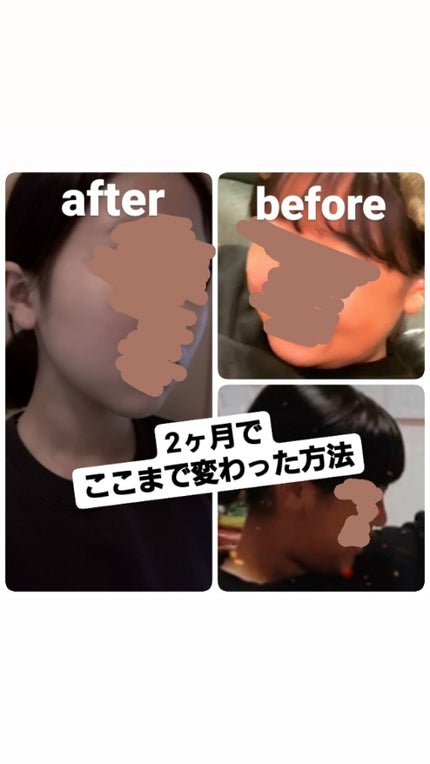 RARA on LIPS 「こんにちは!今回は2ヶ月でパンパンだった顔特に二重アゴを撃退し..」(1枚目)