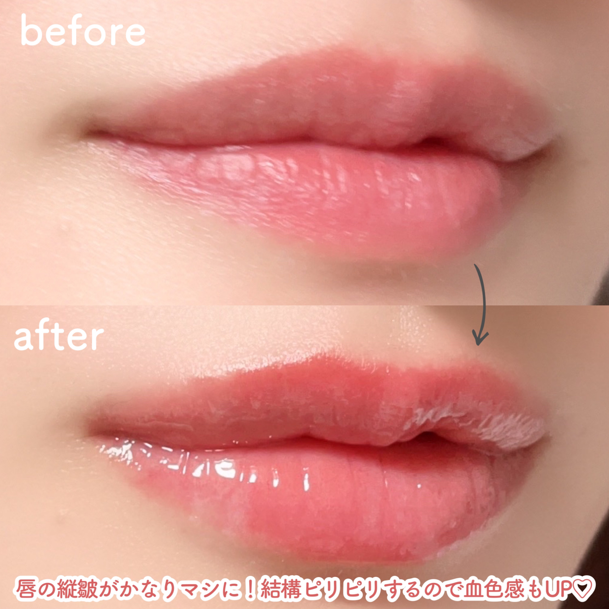 フィー 4Dボリューミングプランパー/fwee/リッププランパーを使ったクチコミ（3枚目）