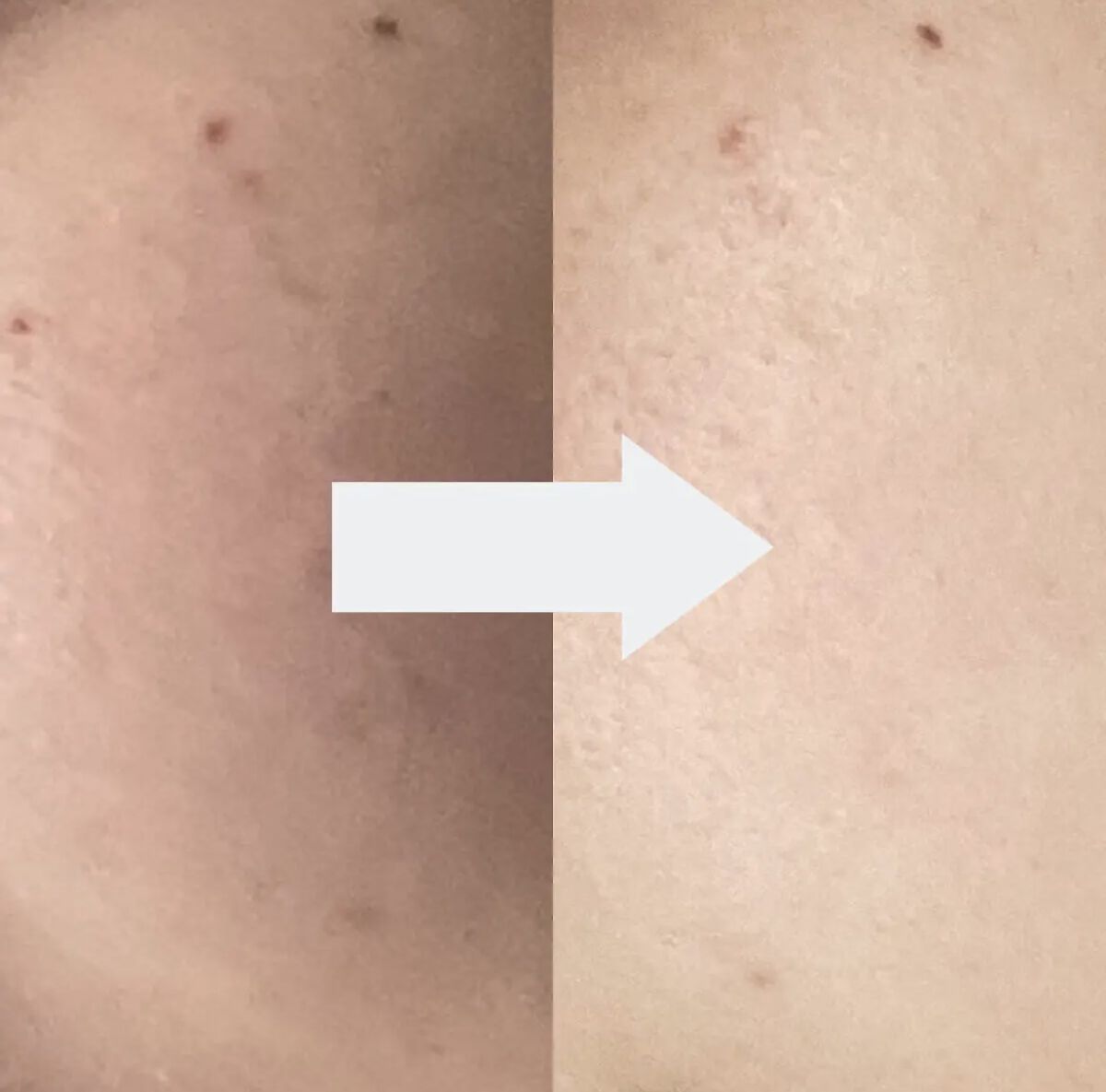 バイオ コンディショニング エッセンス/IOPE/ブースター・導入液を使ったクチコミ（3枚目）