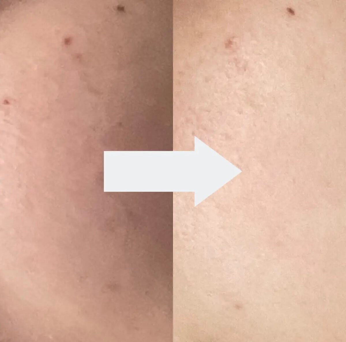 バイオ コンディショニング エッセンス/IOPE/ブースター・導入液を使ったクチコミ(3枚目)