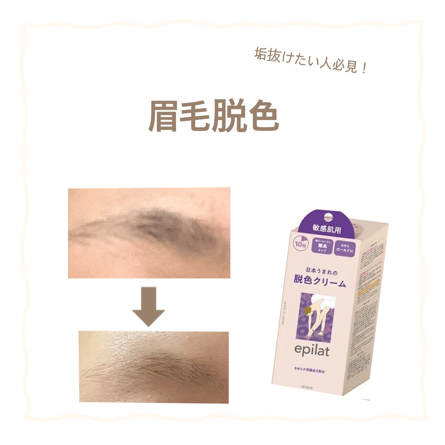 脱色クリーム 敏感肌用/エピラット/ムダ毛ケアを使ったクチコミ(1枚目)