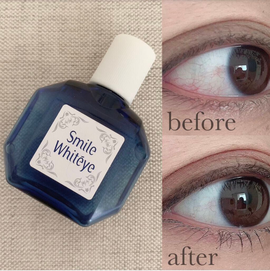 スマイルホワイティエ(医薬品)/ライオン/その他を使ったクチコミ(1枚目)