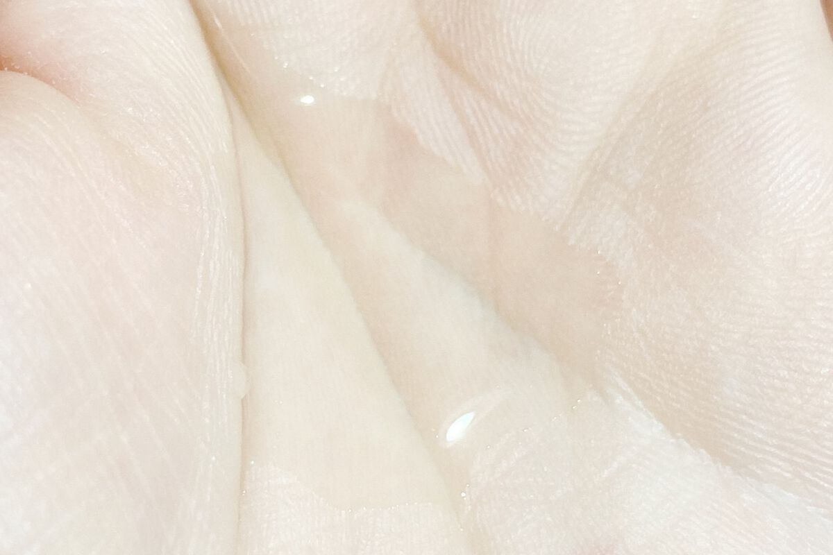 アクネケア 化粧液　＜医薬部外品＞/ファンケル/化粧水を使ったクチコミ（2枚目）