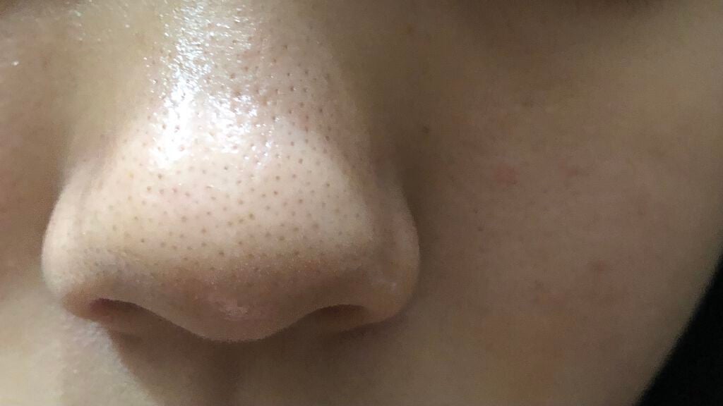 て on LIPS 「【毛穴に悩んでいます】助けてください💦💦💦今高校生で毛穴にずっ..」(2枚目)