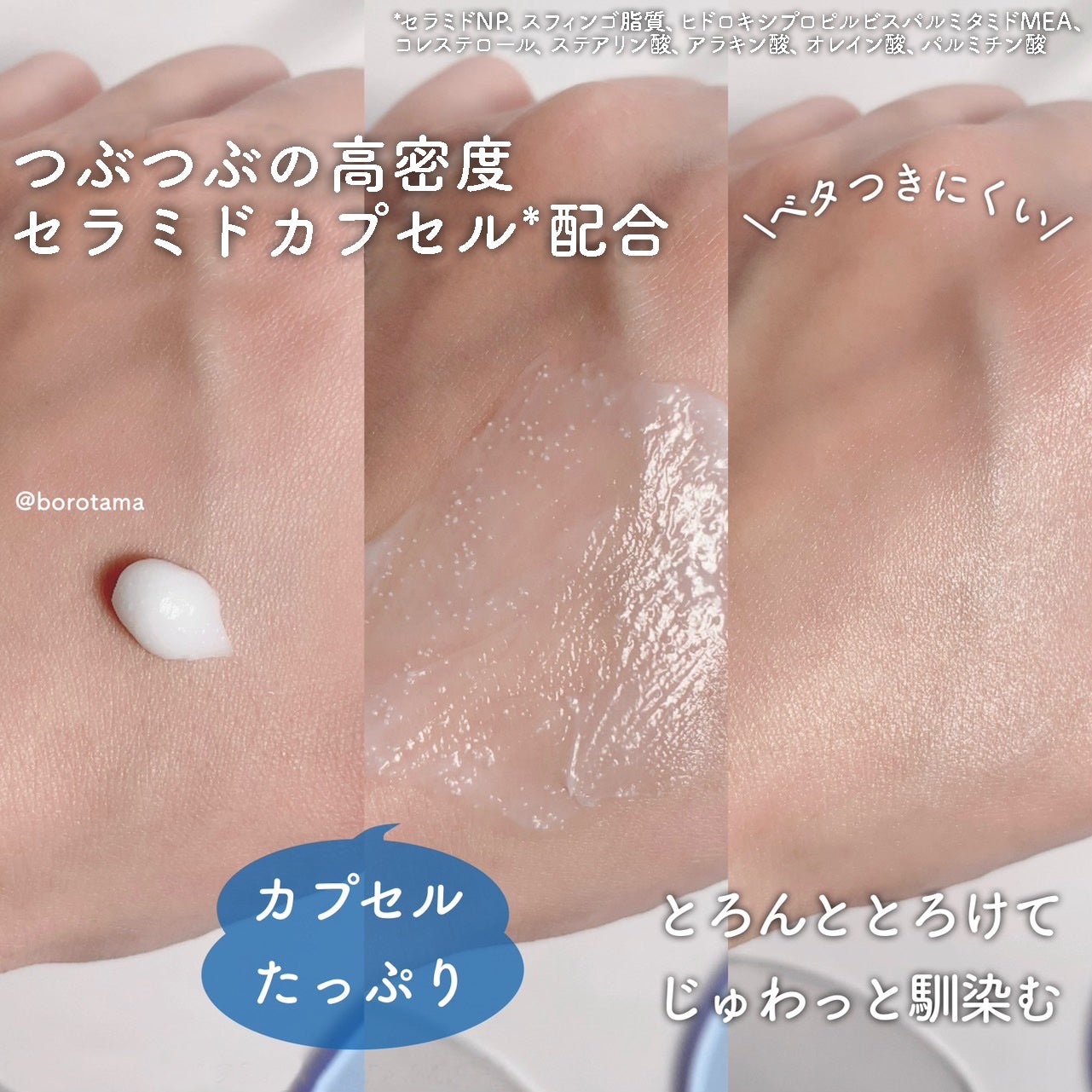 アトバリア365クリーム/AESTURA/フェイスクリームを使ったクチコミ(5枚目)