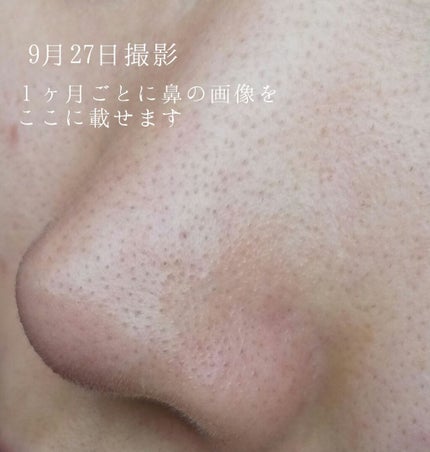 デュオ ザ クレンジングバーム クリア/DUO/クレンジングバームを使ったクチコミ(4枚目)