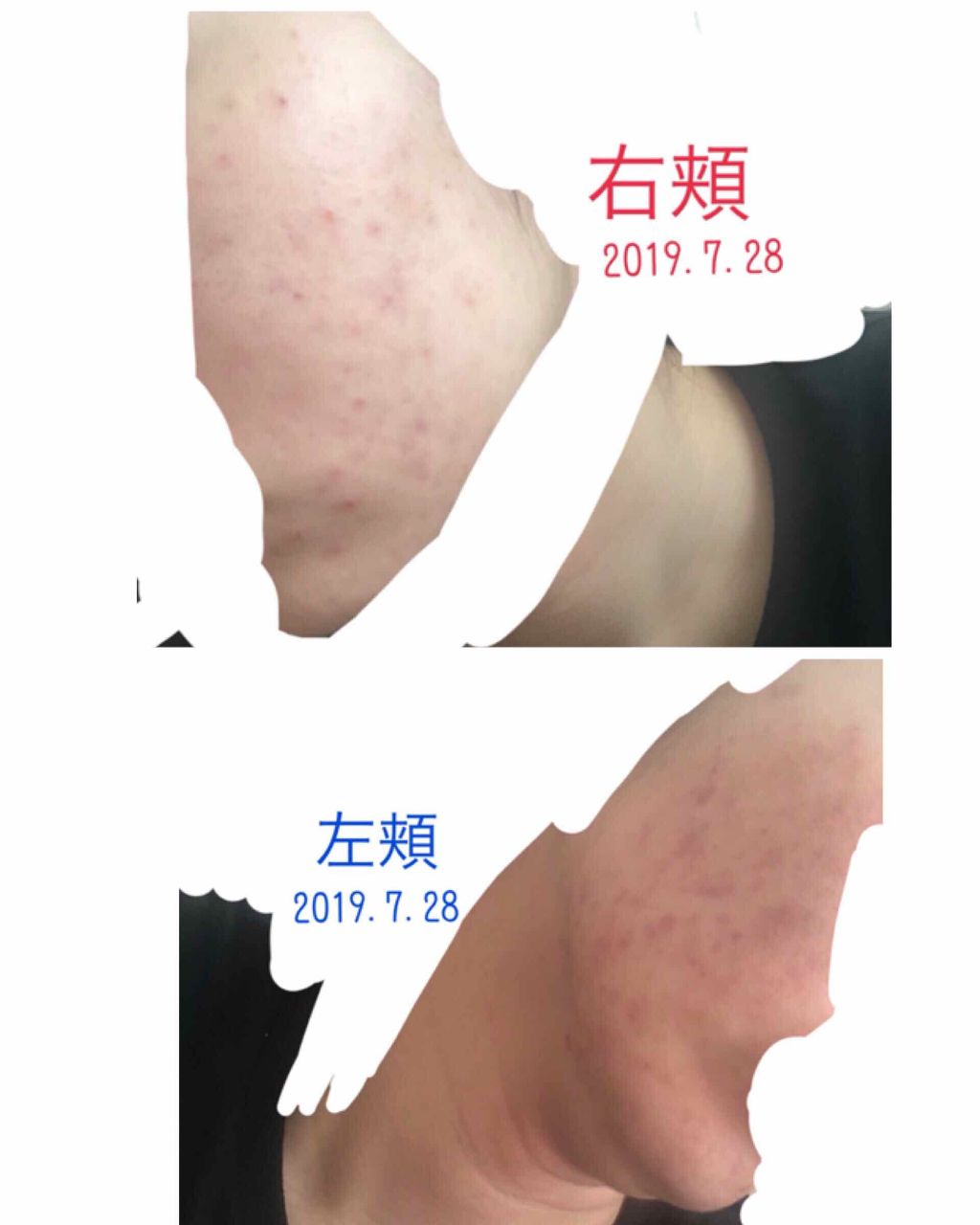 ソフティモ 薬用ホワイト クレンジングウォッシュ/ソフティモ/洗顔フォームを使ったクチコミ（3枚目）