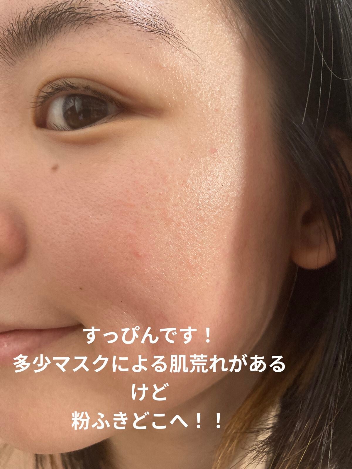 リンクルエッセンスクリーム/モイスタージュ/フェイスクリームを使ったクチコミ(3枚目)