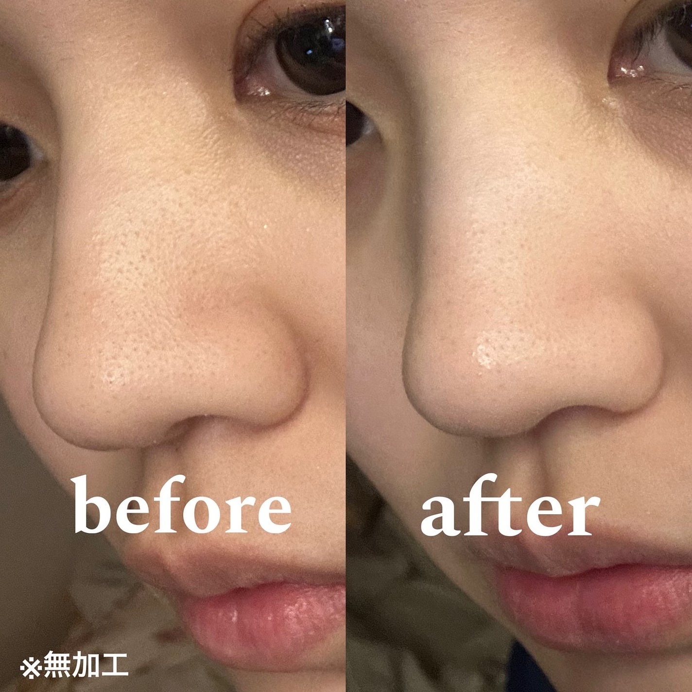 ブラックジェルクレンジング/.akaran/クレンジングジェルを使ったクチコミ(4枚目)