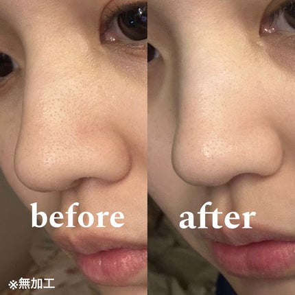 ブラックジェルクレンジング/.akaran/クレンジングジェルを使ったクチコミ(4枚目)