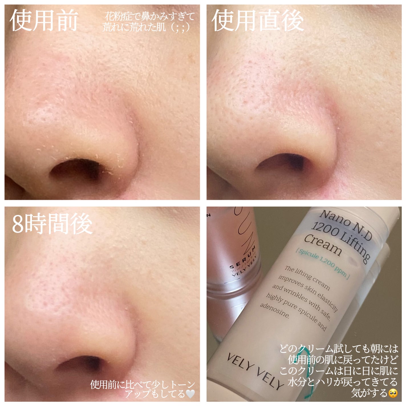 ナノ ニードル 1200 リフティングクリーム/VELY VELY/フェイスクリームを使ったクチコミ(2枚目)