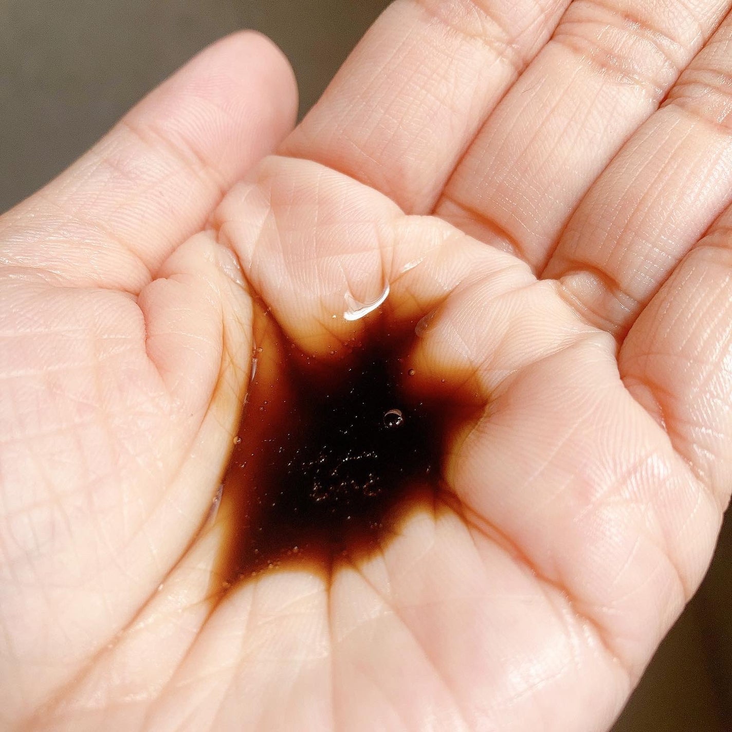 プロヘマチン原液 ヒト幹細胞培養エキス+/fracora/洗い流すヘアトリートメントを使ったクチコミ(4枚目)