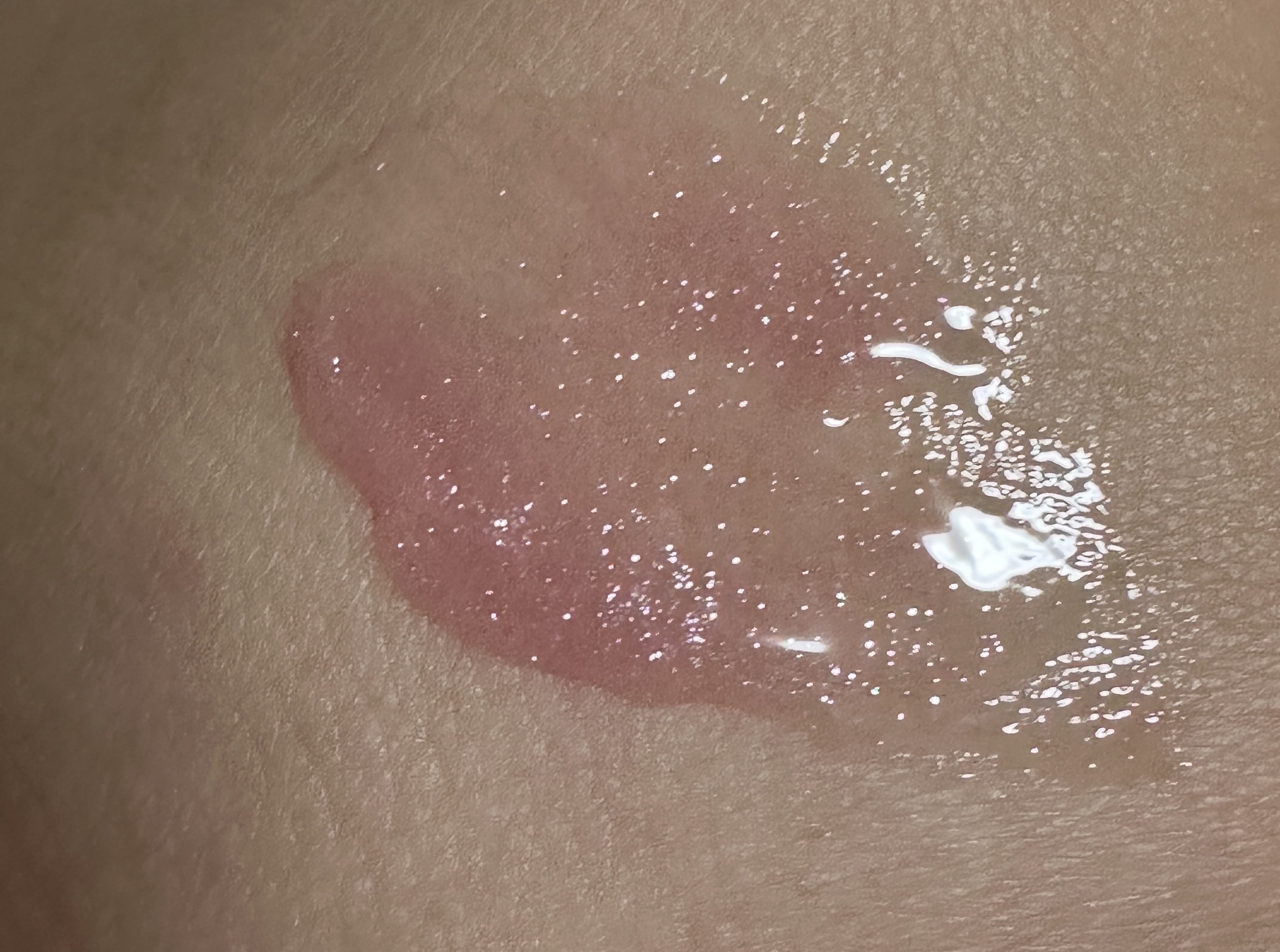 ちゅるリップランパー/muice/リッププランパーを使ったクチコミ（2枚目）