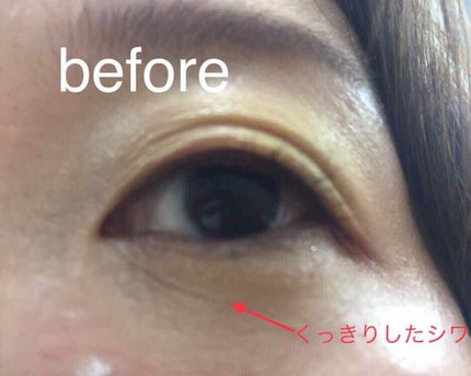 リンクルリセッター/BENEFIQUE/クリームコンシーラーを使ったクチコミ(3枚目)