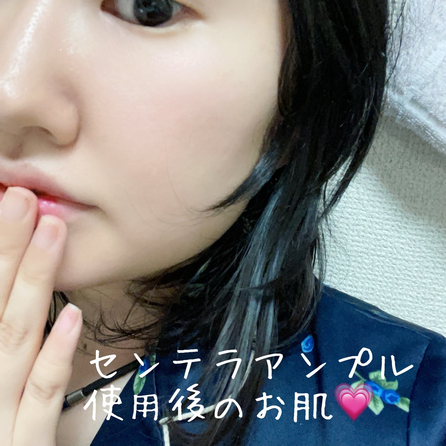 センテラ アンプル/SKIN1004/美容液を使ったクチコミ(4枚目)