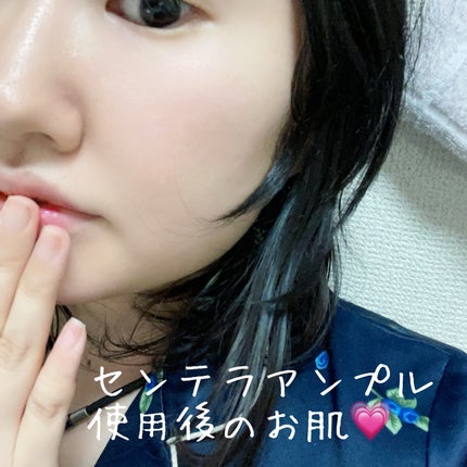 センテラ アンプル/SKIN1004/美容液を使ったクチコミ(4枚目)