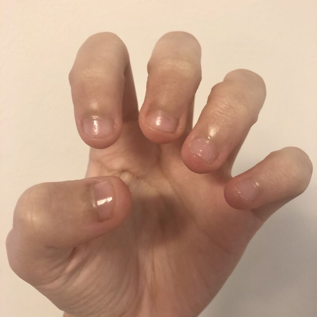 ハンドベール プレミアムリッチネイル メンソレータムを使った口コミ 爪噛み癖をしっかりと治す 爪噛みについて By れもん 乾燥肌 10代後半 Lips
