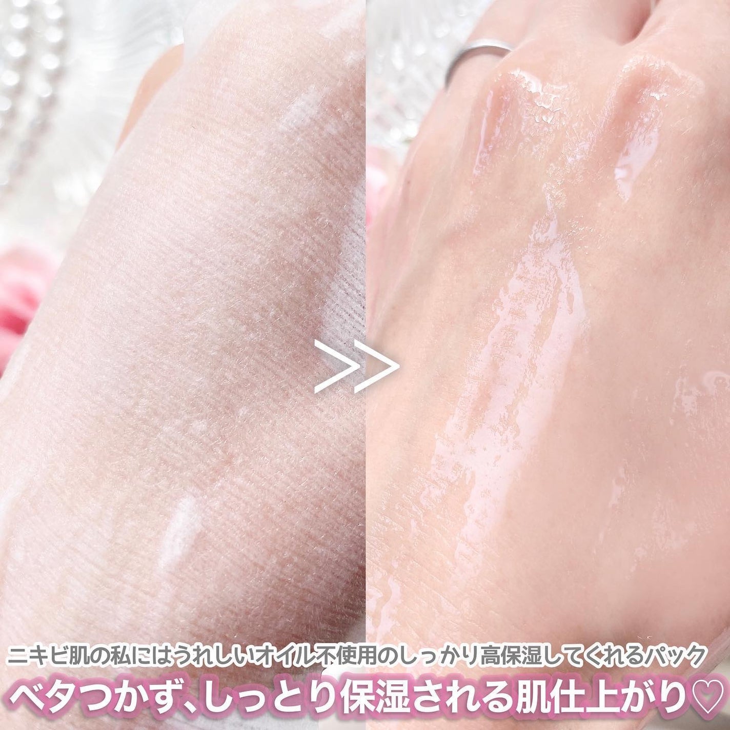 ごめんね素肌マスク/クリアターン/シートマスク・パックを使ったクチコミ(8枚目)