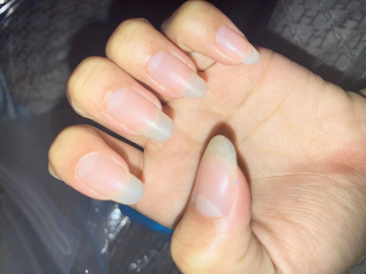 ピタキュア/ARIANA化粧品/その他を使ったクチコミ（2枚目）