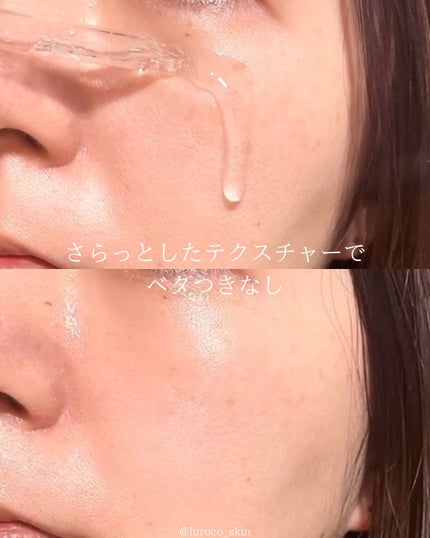 チェリーブロッサムブレミッシュ8GFセラム/Bring Back/化粧水を使ったクチコミ(5枚目)