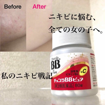 チョコラBBプラス (医薬品)/チョコラBB/その他を使ったクチコミ(1枚目)