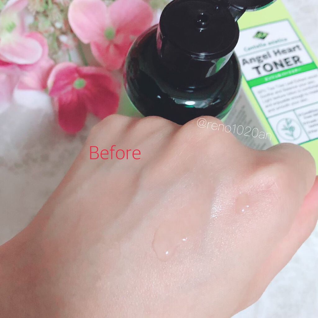 エンジェルハートトナー/エンジェルハート/化粧水を使ったクチコミ（2枚目）