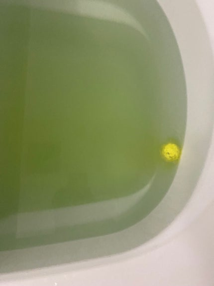 ぷぅぴぃ《紫コス部💜💗》 on LIPS 「スプラトゥーンᔦఠఠᔨVSᔦꙬᔨ3バスボールᔦ๑°꒳°๑..」(4枚目)