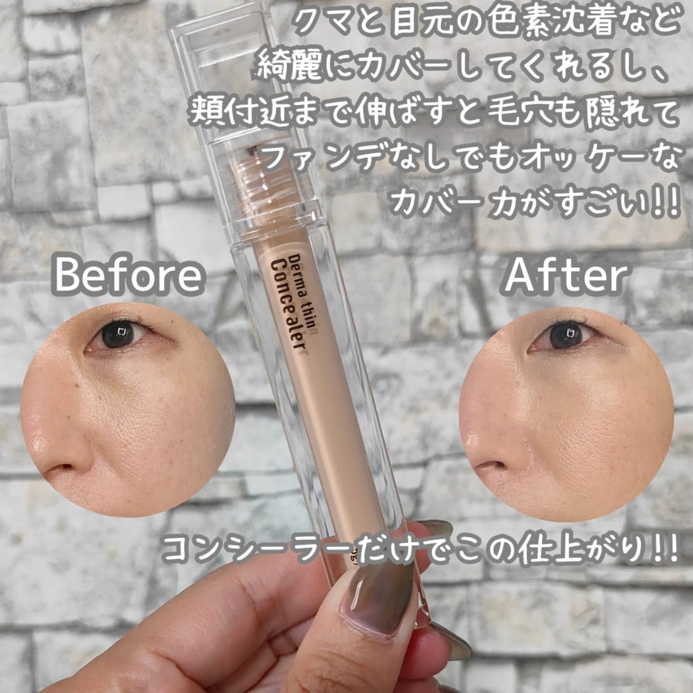 ダーマシンコンシーラー/23years old/リキッドコンシーラーを使ったクチコミ(3枚目)