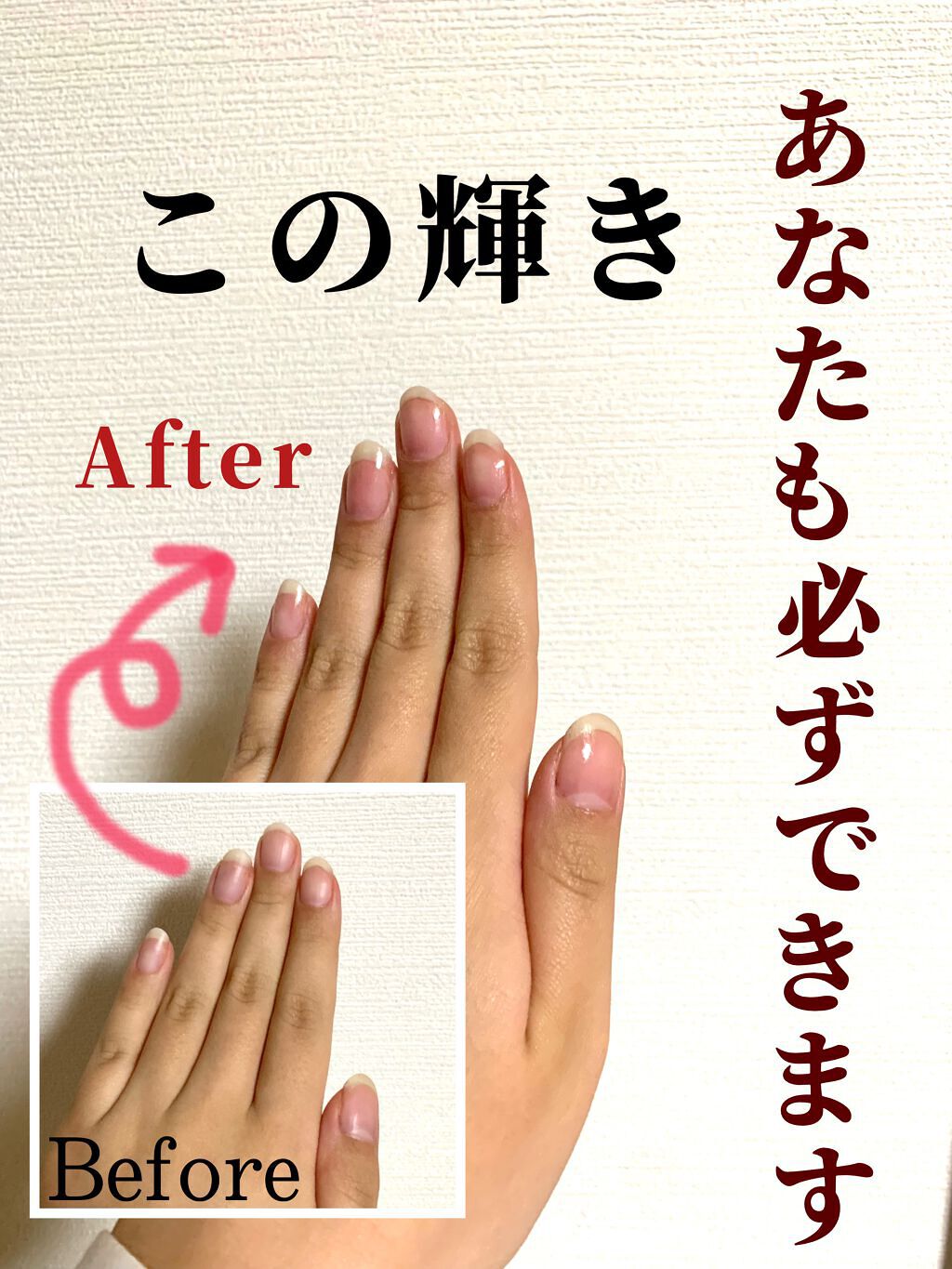 エテュセ クイックケアコート/ettusais/ネイルオイル・トリートメントを使ったクチコミ（1枚目）