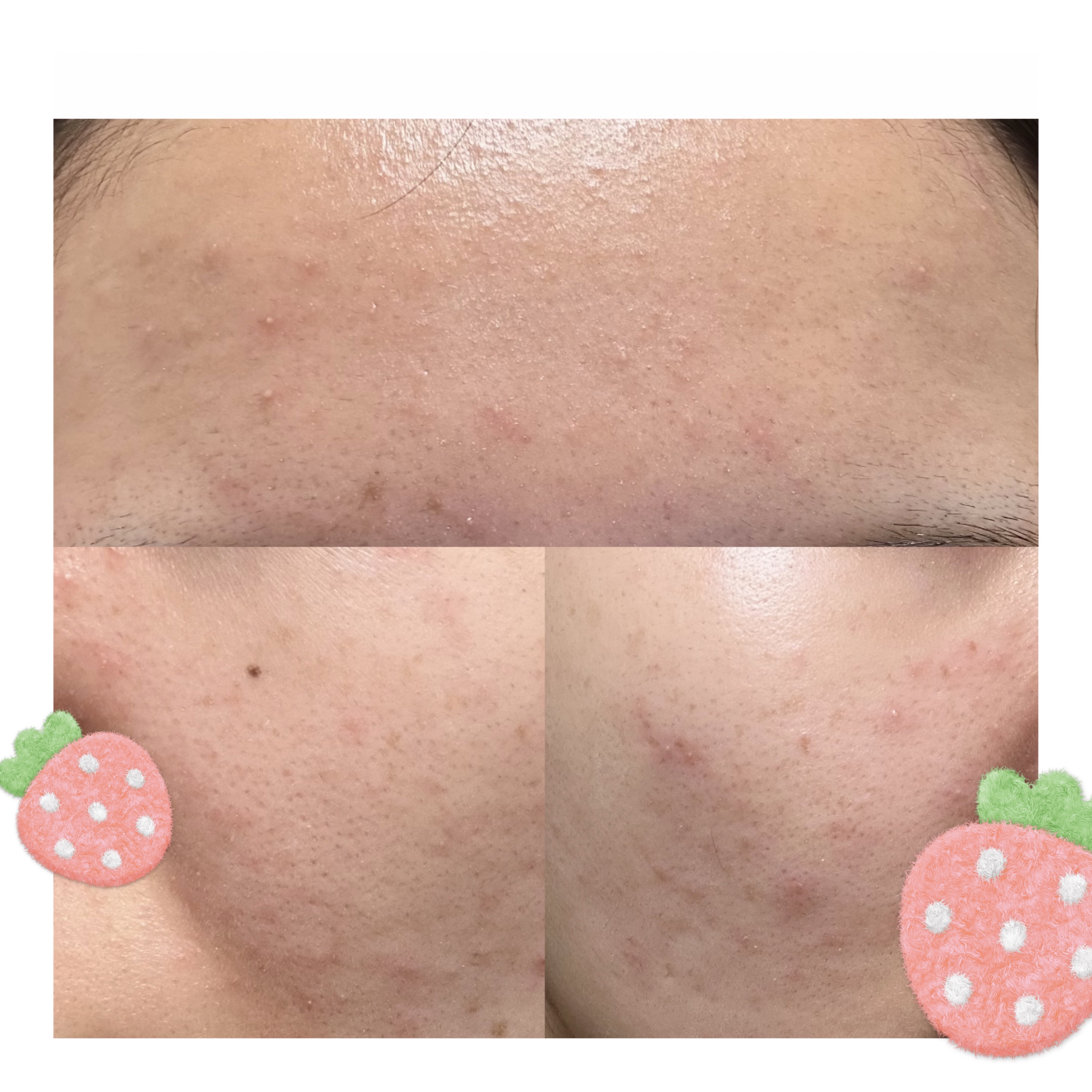 ガラクナイアシン2.0エッセンス/manyo/美容液を使ったクチコミ（2枚目）