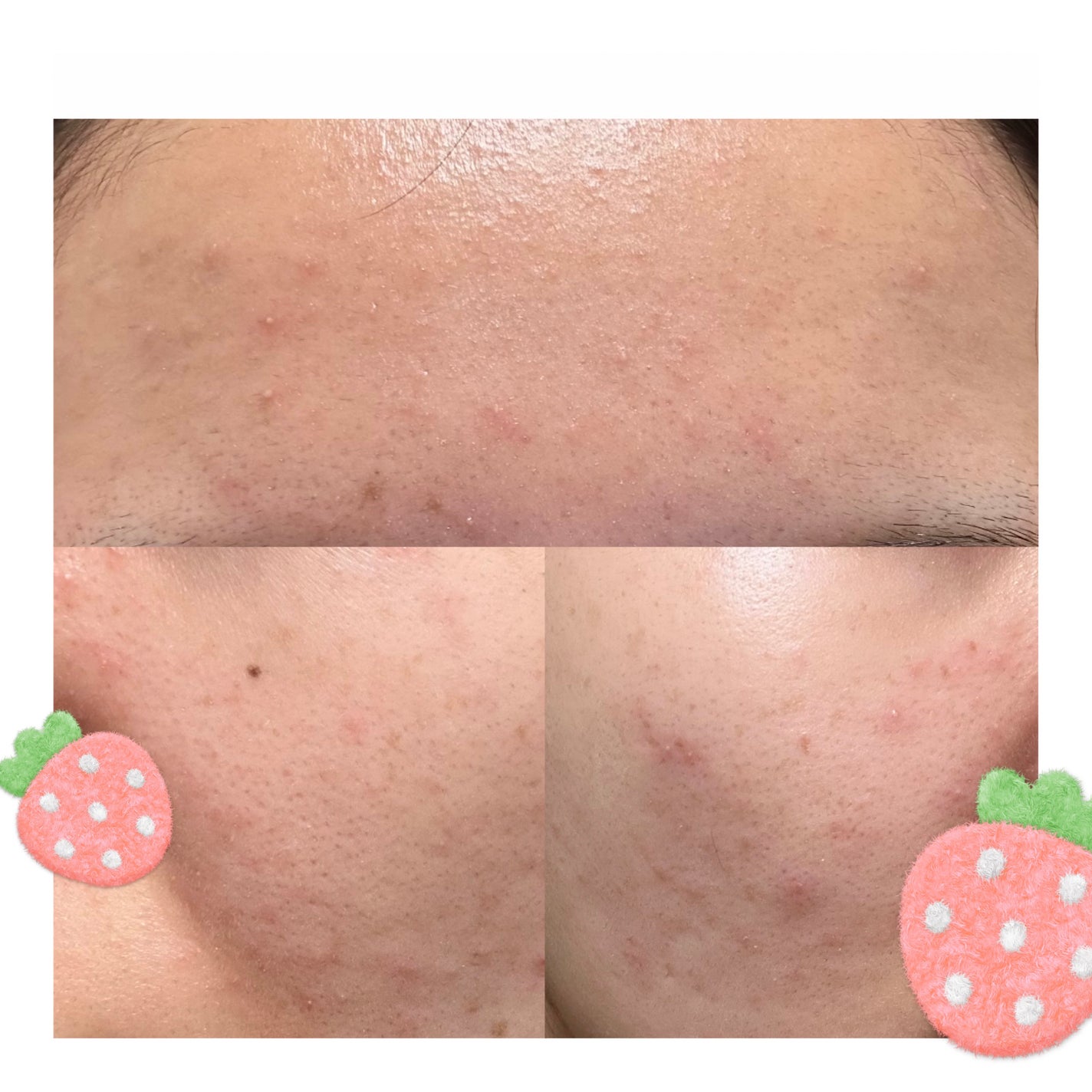 ガラクナイアシン2.0エッセンス/manyo/美容液を使ったクチコミ(2枚目)