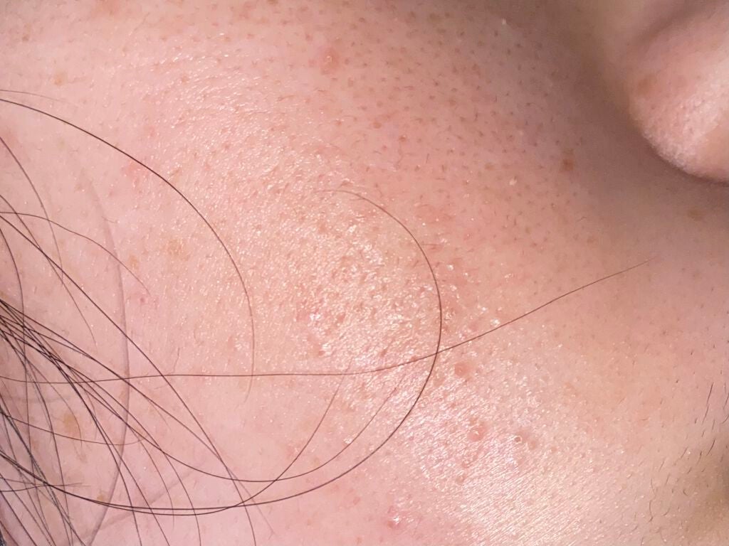 ビビ on LIPS 「顔面記録9日目昨日の更新出来ずサボった感が出てしまって申し訳な..」(4枚目)