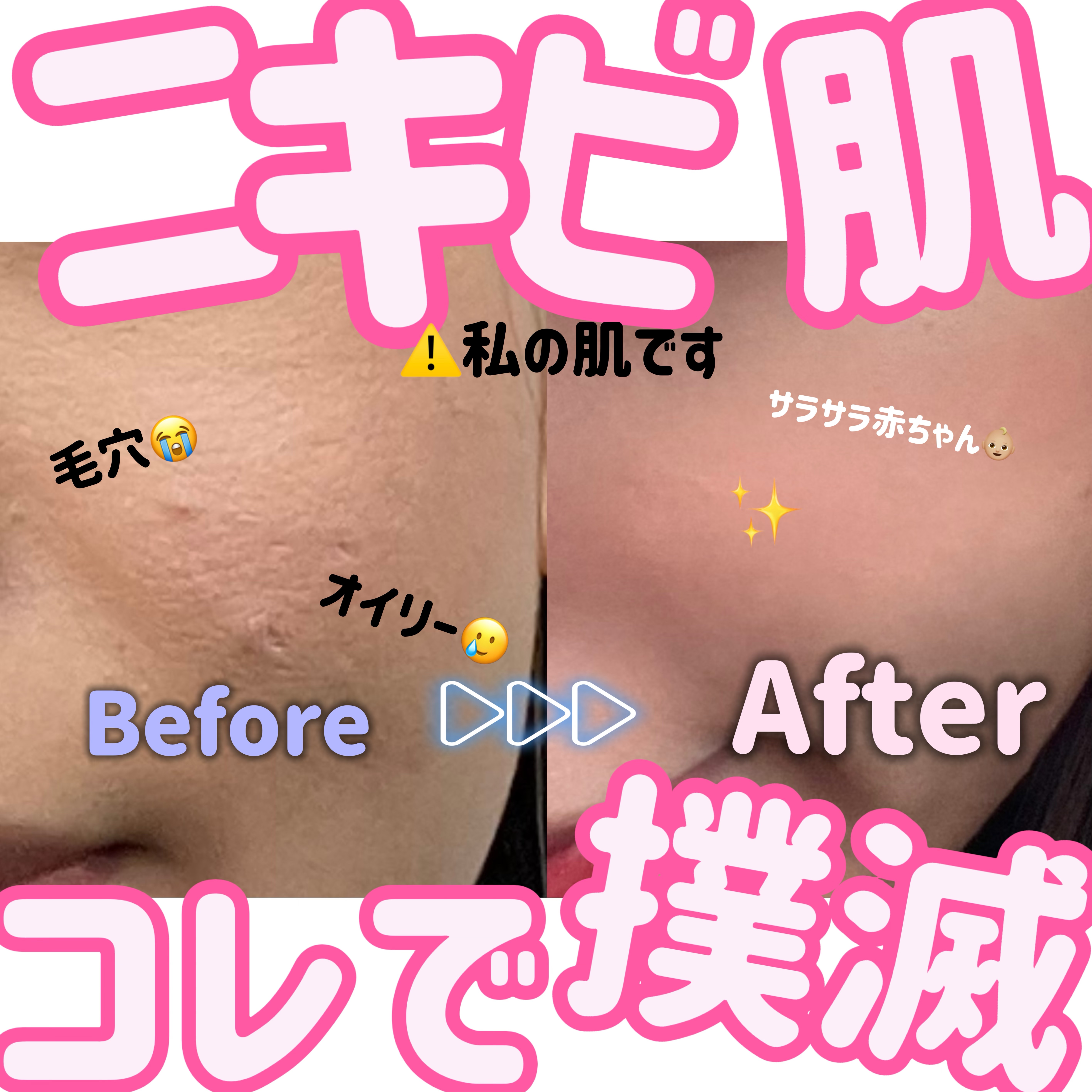 DHC ビタミンBミックス/DHC/美容サプリメントを使ったクチコミ（1枚目）