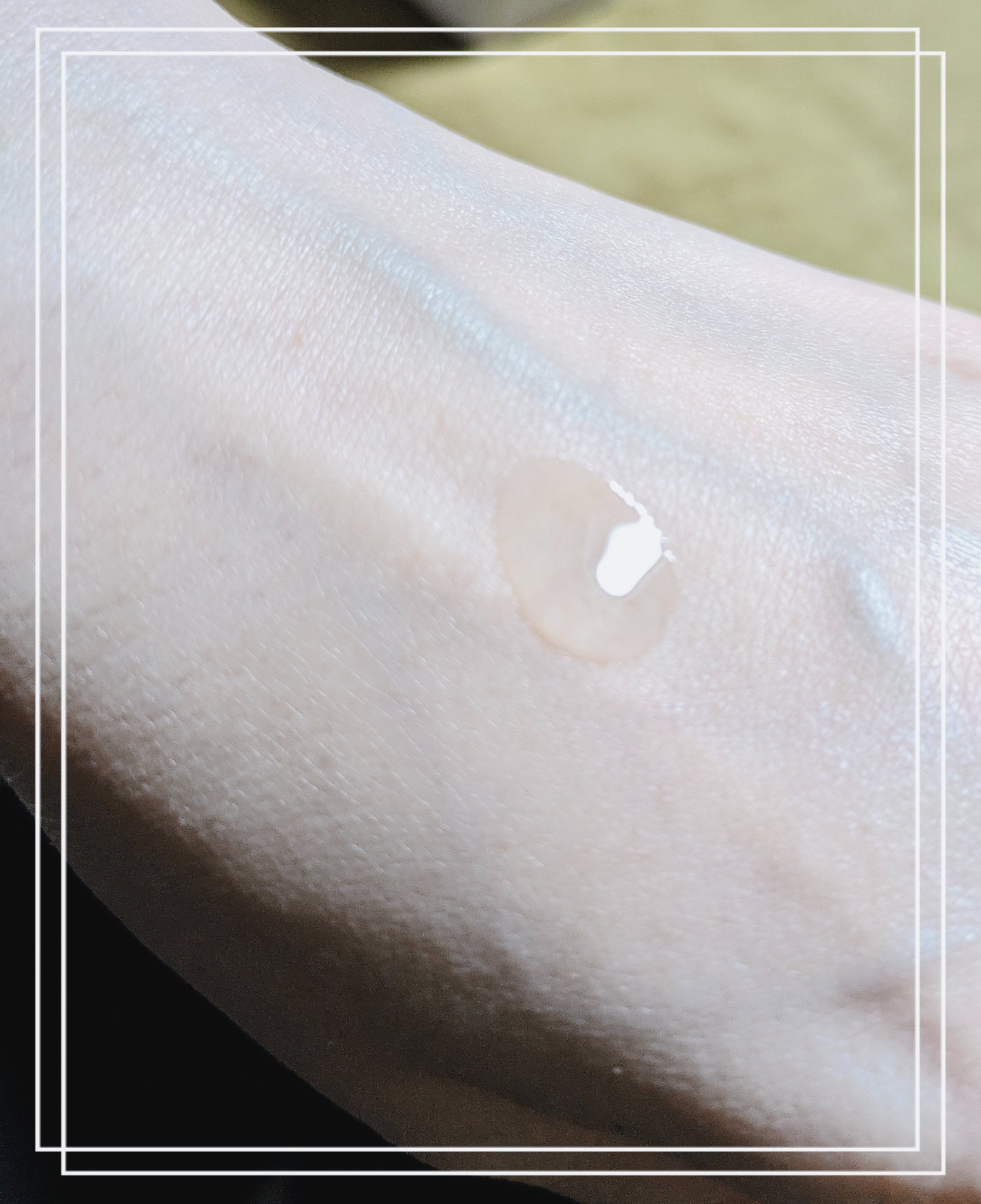 センテラ アンプル/SKIN1004/美容液を使ったクチコミ（3枚目）