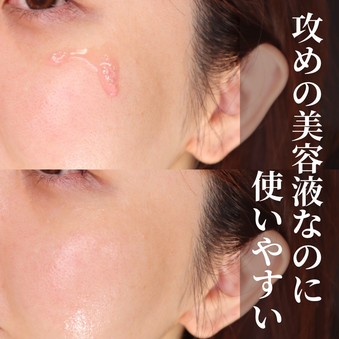 ダークスポットセラム/Anua/美容液を使ったクチコミ(5枚目)