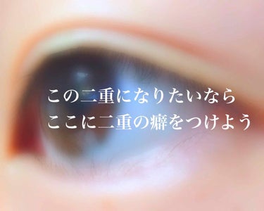 一重、奥二重の皆さん二重になるなら自分好みの二重にしたくないですか？




そう。一重、奥二重の方は自分で好きな二重にできるチャンスをもった人達なんです！！




しっかぁぁしっ！！
なかなか自分好