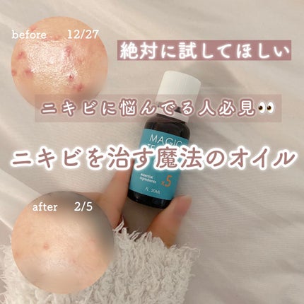 マジックティーツリーオイル/ブラン/フェイスオイルを使ったクチコミ(1枚目)