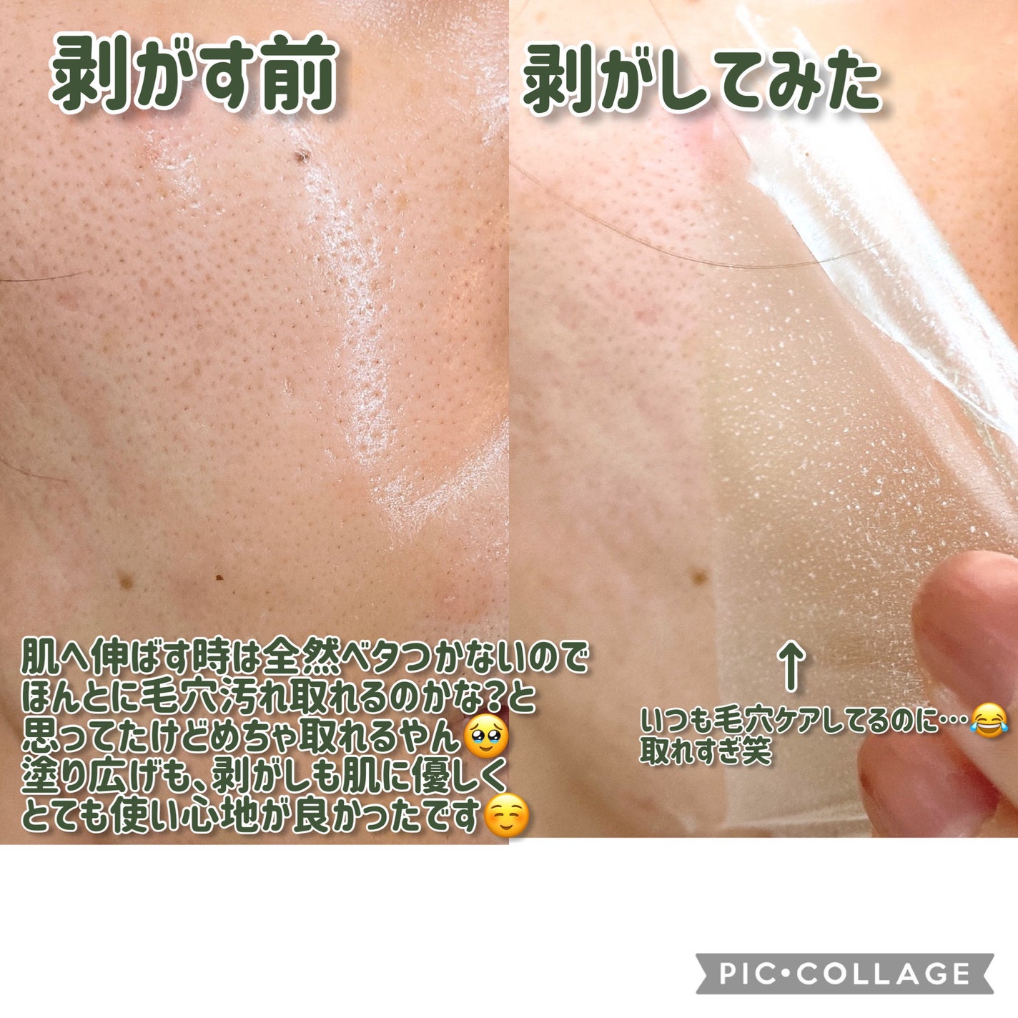 REAL CICA PEEL OFF PACK/Aetem /シートマスク・パックを使ったクチコミ(4枚目)